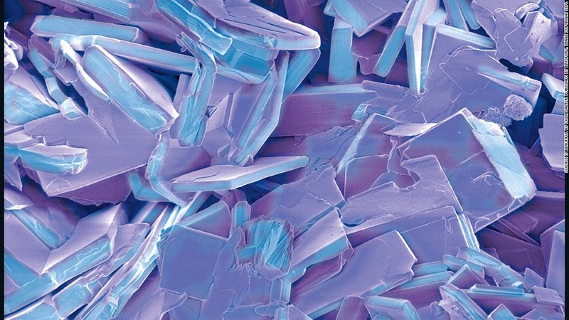желчнокаменный кристалл.jpg